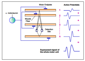 EMG distance to electrode
