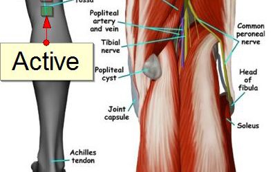 Popliteal Fossa Potential: How and Why To Set It Up