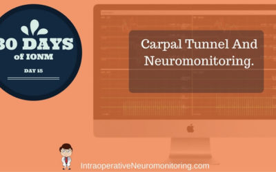 How Carpal Tunnel Syndrome Has Central Consequences That Affects Neuromonitoring