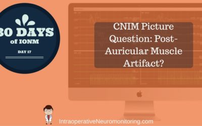 CNIM Picture Question – Post-Auricular Muscle Artifact Or Middle Latency ABR?