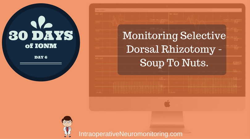 Monitoring For Selective Dorsal Rhizotomy – Soup To Nuts