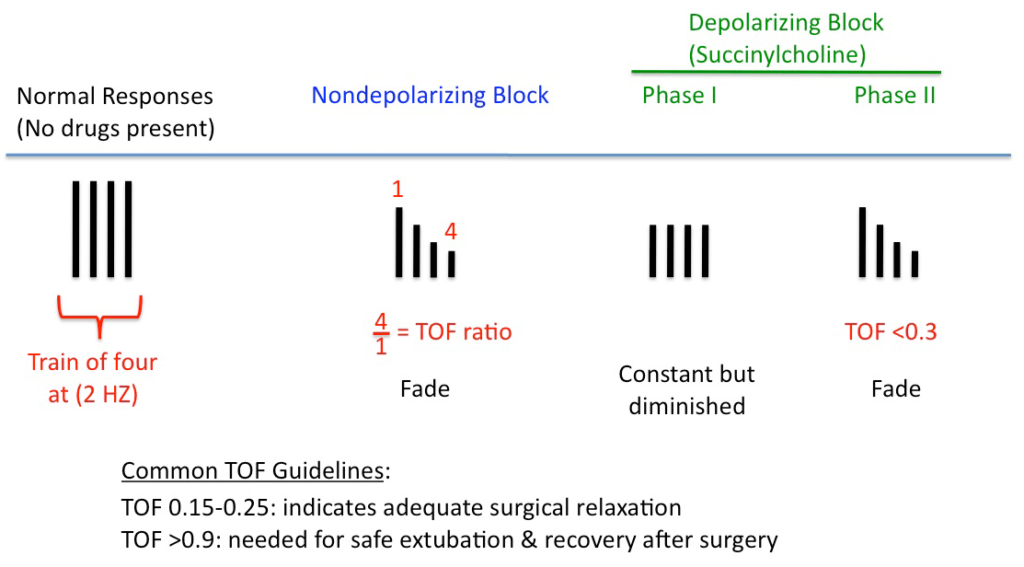 Peripheral Nerve Stimulator - Train of Four Monitoring: Overview