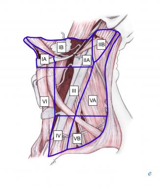 How To Use The Trapezius Muscle In Intraoperative EMG and ... neck lymph node levels diagram 