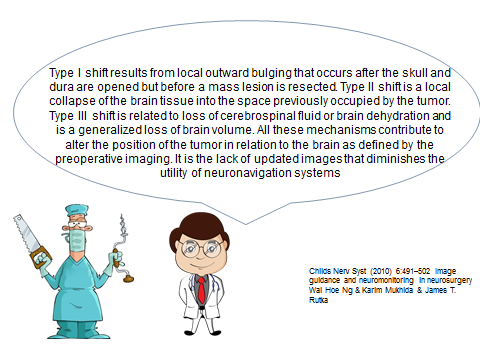 brain shift during surgery