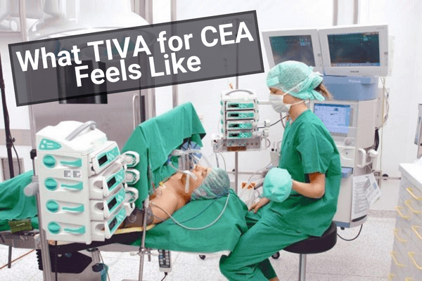 TIVA for CEA EEG